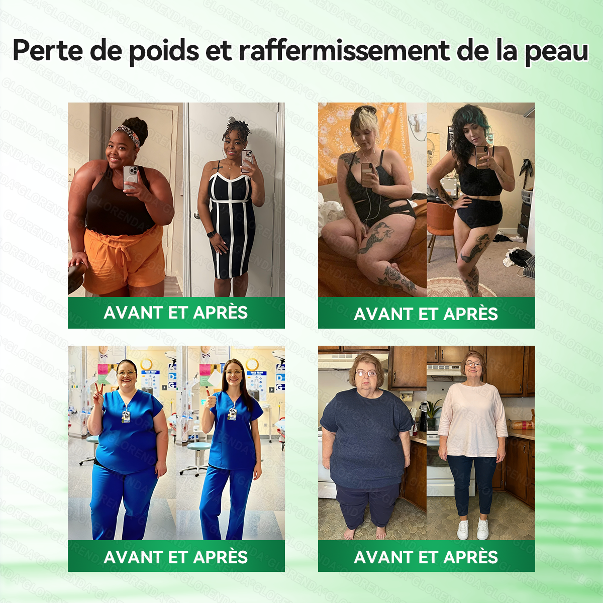 Boutique officielle ❤️‍🔥❤️‍🔥𝐆𝐋𝐎𝐑𝐄𝐍𝐃𝐀® Moringa · Berbérine + NAD+ – Patch Microneedle Nano Avancé 10-en-1 (1×/jour, résultats visibles en 7 jours) | Obésité, relâchement cutané, apnée du sommeil, articulations, etc.-LYJ