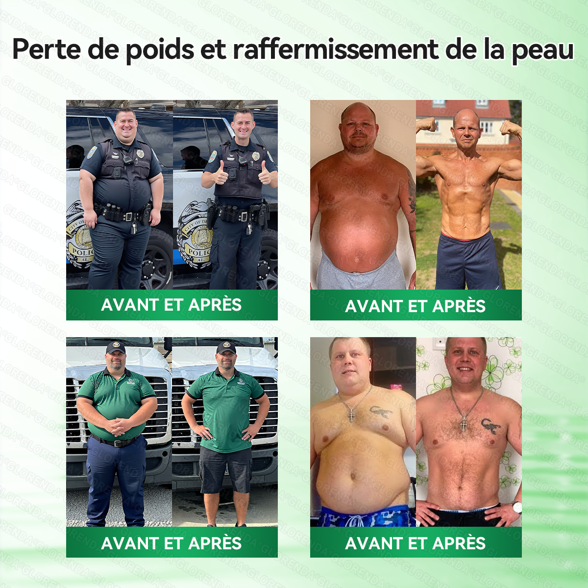 Boutique officielle ❤️‍🔥❤️‍🔥𝐆𝐋𝐎𝐑𝐄𝐍𝐃𝐀® Moringa · Berbérine + NAD+ – Patch Microneedle Nano Avancé 10-en-1 (1×/jour, résultats visibles en 7 jours) | Obésité, relâchement cutané, apnée du sommeil, articulations, etc.-LYJ